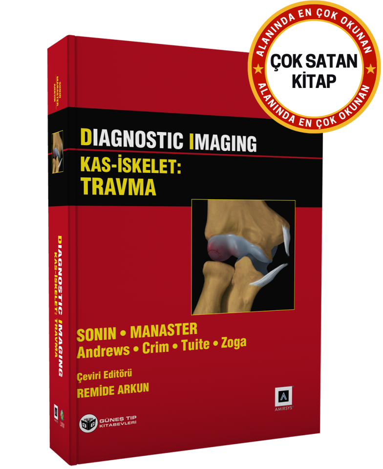Diagnostic Imaging - Kas İskelet: Travma