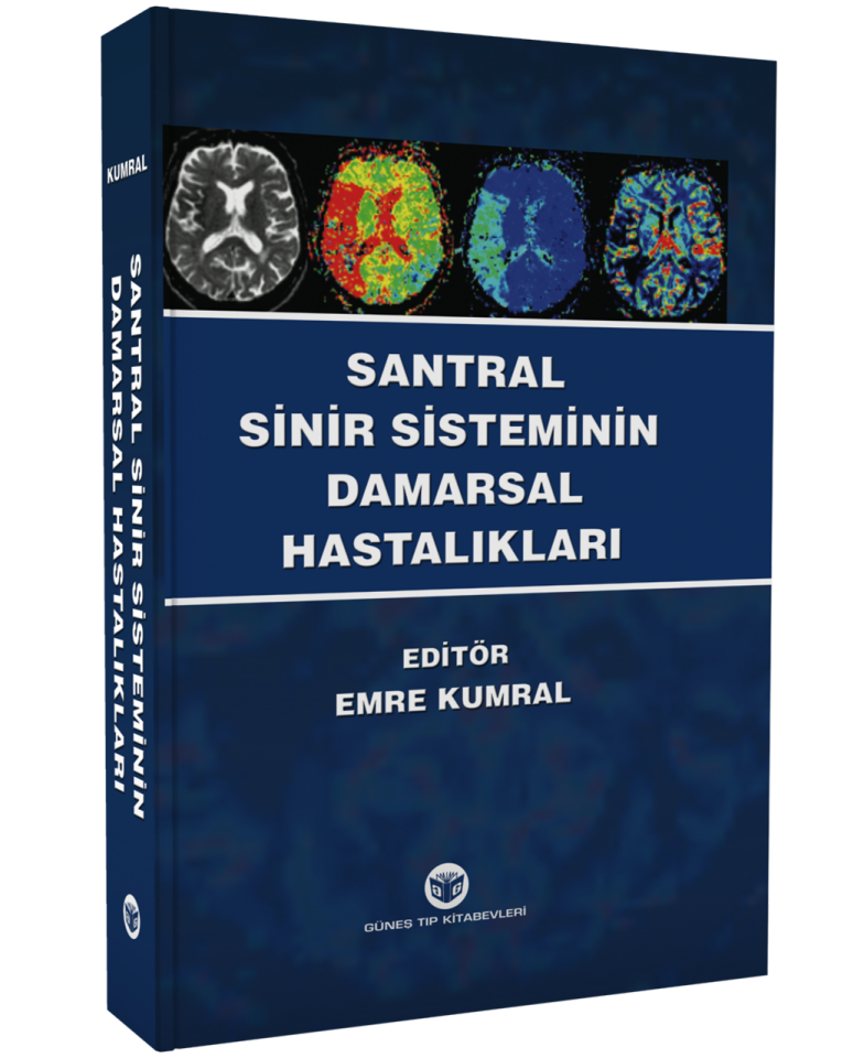 Santral Sinir Sisteminin Damarsal Hastalıkları