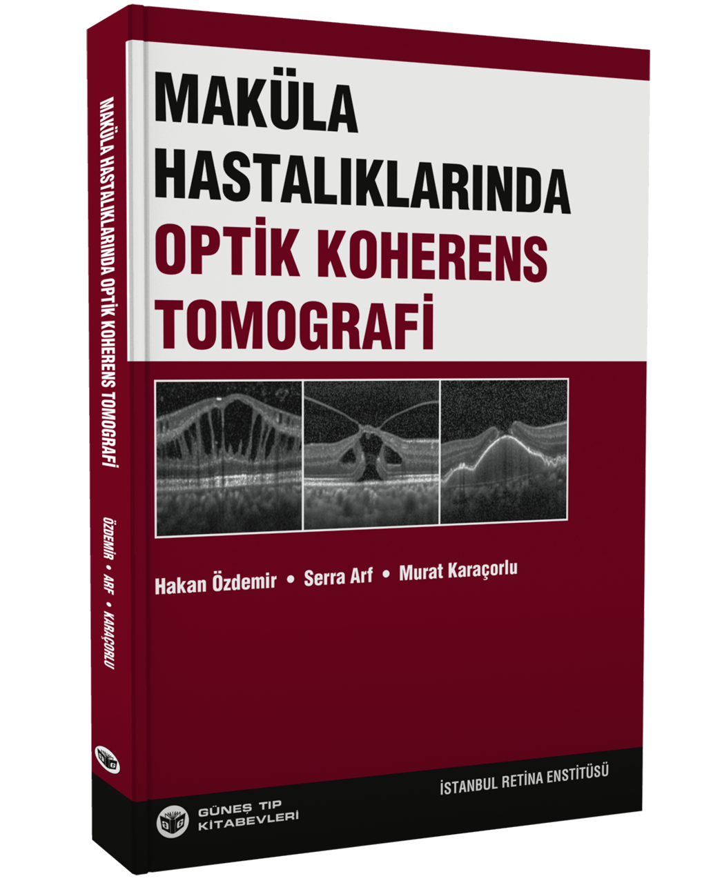 Maküla Hastalıklarında Optik Koherens Tomografi