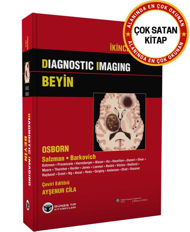 Diagnostic Imaging - Beyin