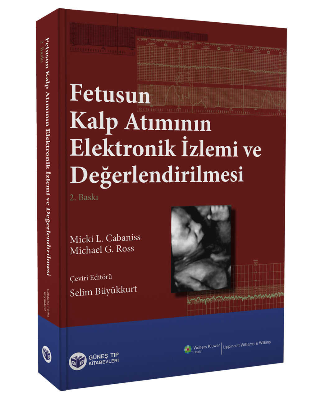 Fetusun Kalp Atımının Elektronik İzlemi ve Değerlendirilmesi