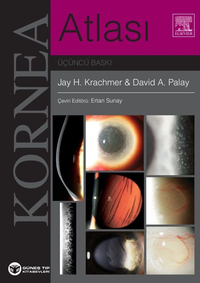 Krachmer Kornea Atlası