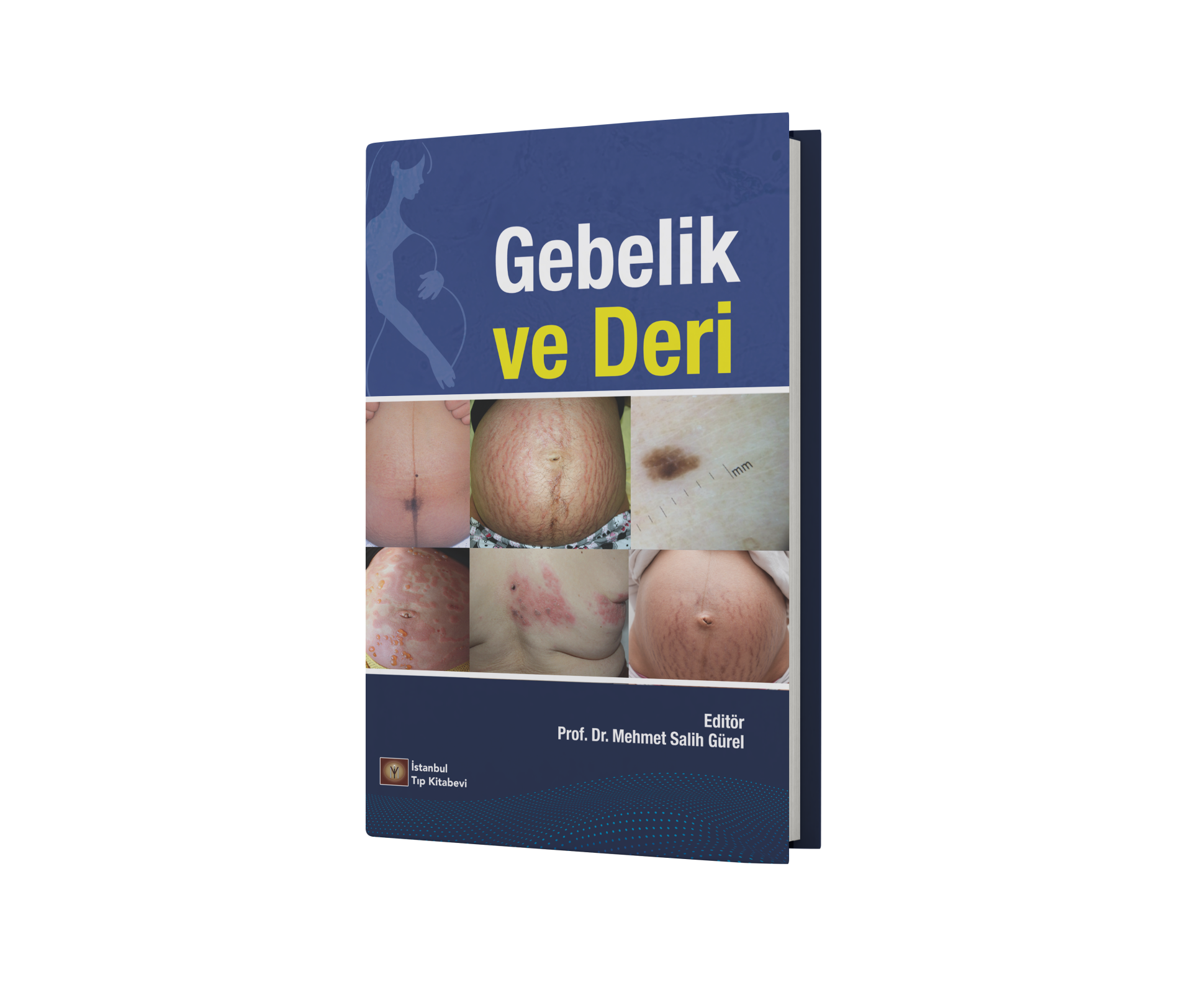 Gebelik ve Deri