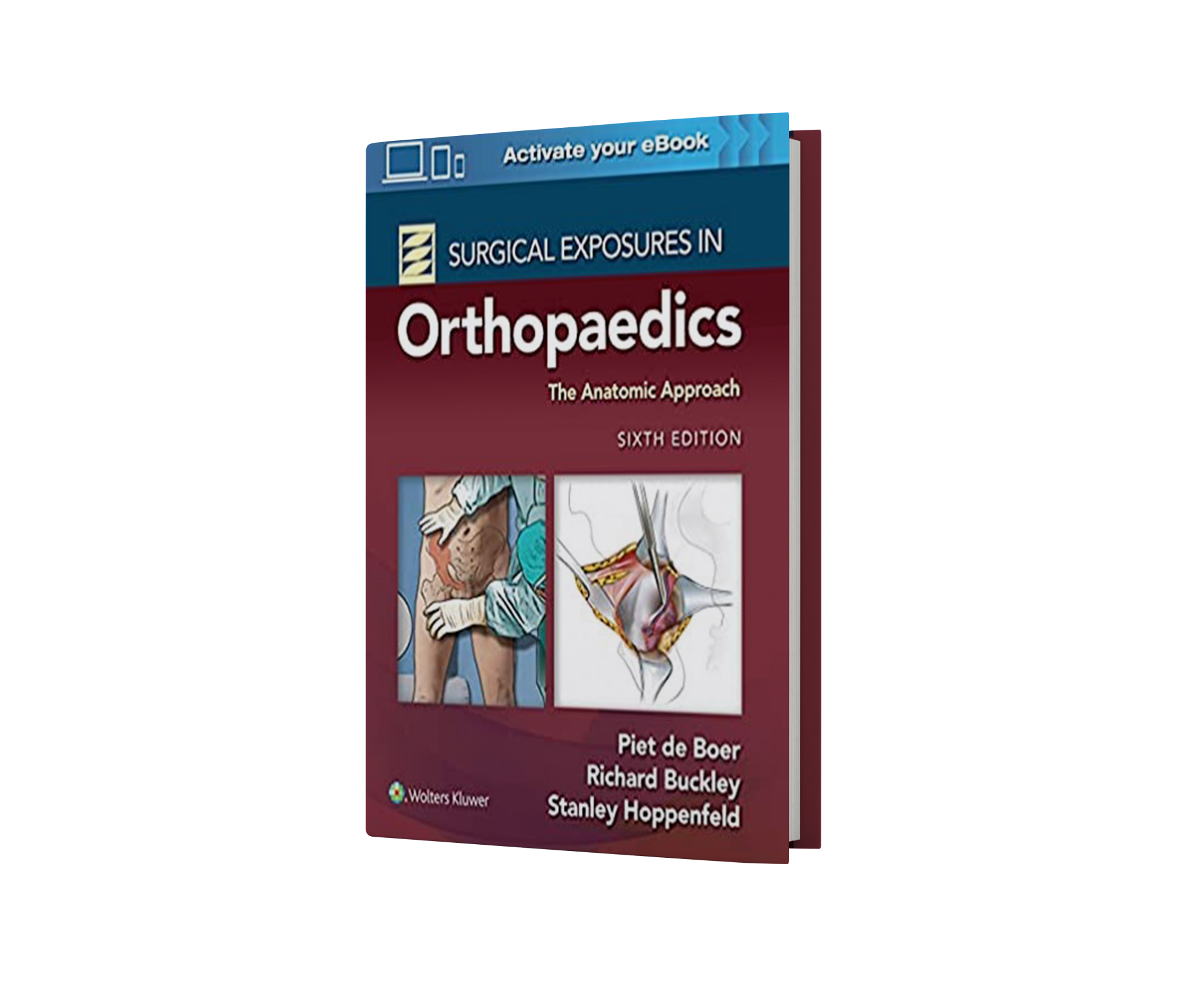 Surgical Exposures in Orthopaedics: The Anatomic Approach