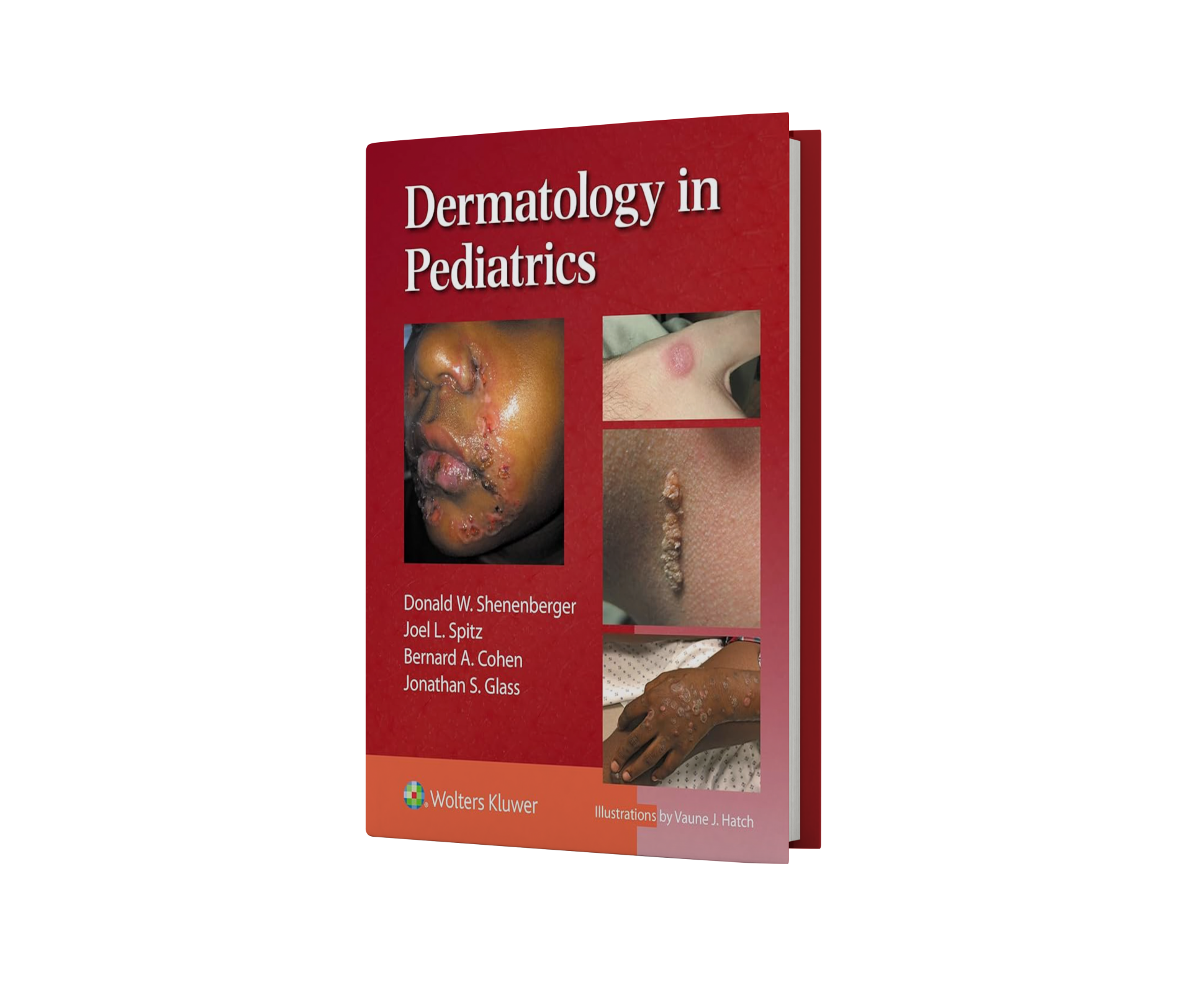 Dermatology in Pediatrics