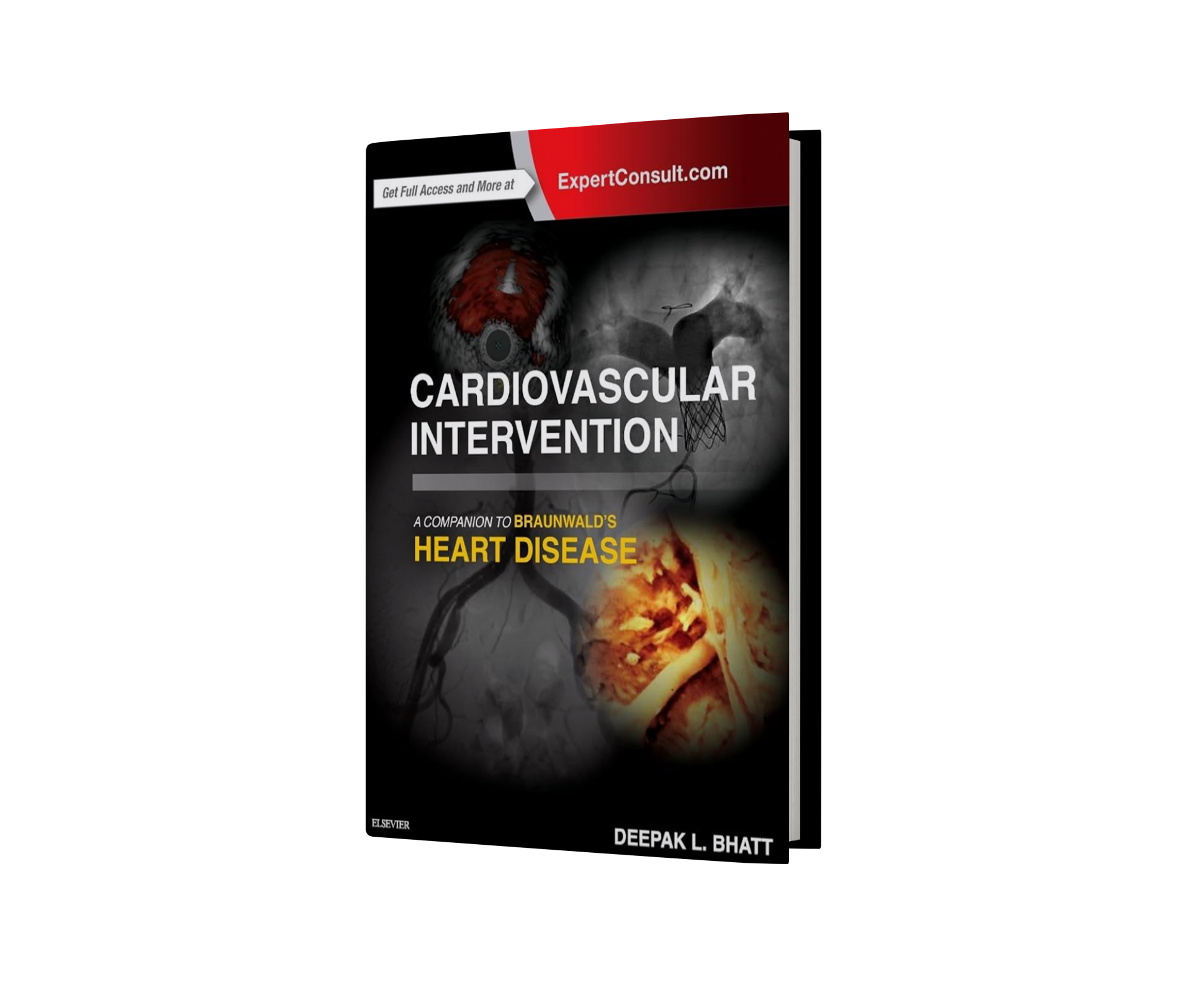 Cardiovascular Intervention: A Companion to Braunwald’s Heart Disease